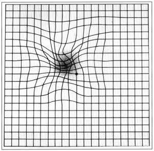 Degenerescência Macular Relacionada com a Idade — ilustração