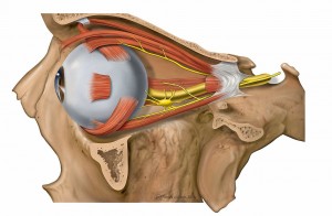 O que é o Glaucoma? — ilustração