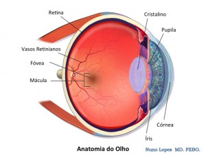 O que significa ter a lente intraocular “suja”? — ilustração