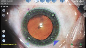 Erro Refractivo — ilustração