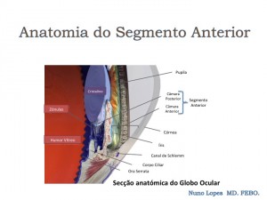 O laser ou a Cirurgia podem curar o meu Glaucoma? — ilustração